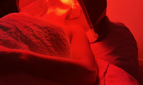 Addressing Melasma – My Hormonal Skin Journey