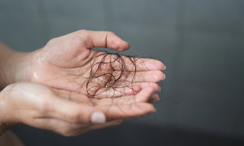 Postpartum Hair Loss